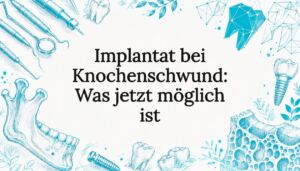 Gestaltete Titelgrafik zum Thema Zahnimplantate